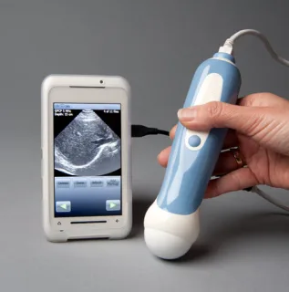 Piquing Our Geek - Mobisante smart phone ultrasound device 
