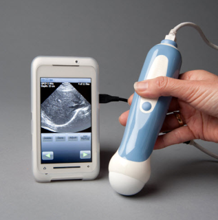 Piquing Our Geek – Mobisante smart phone ultrasound device